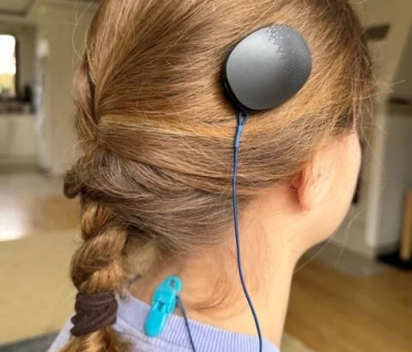 Cochlear implants2